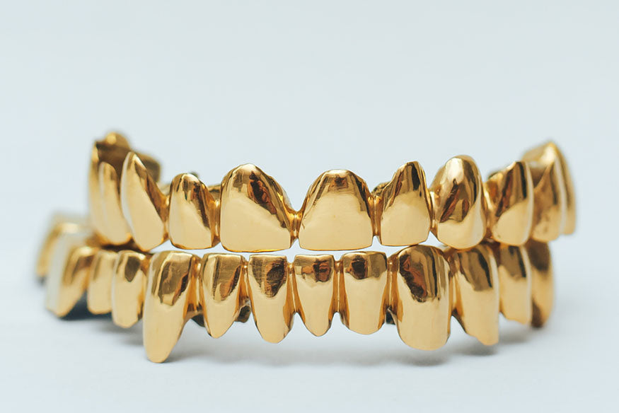 How Much is a Gold Grill? – FrostNYC
