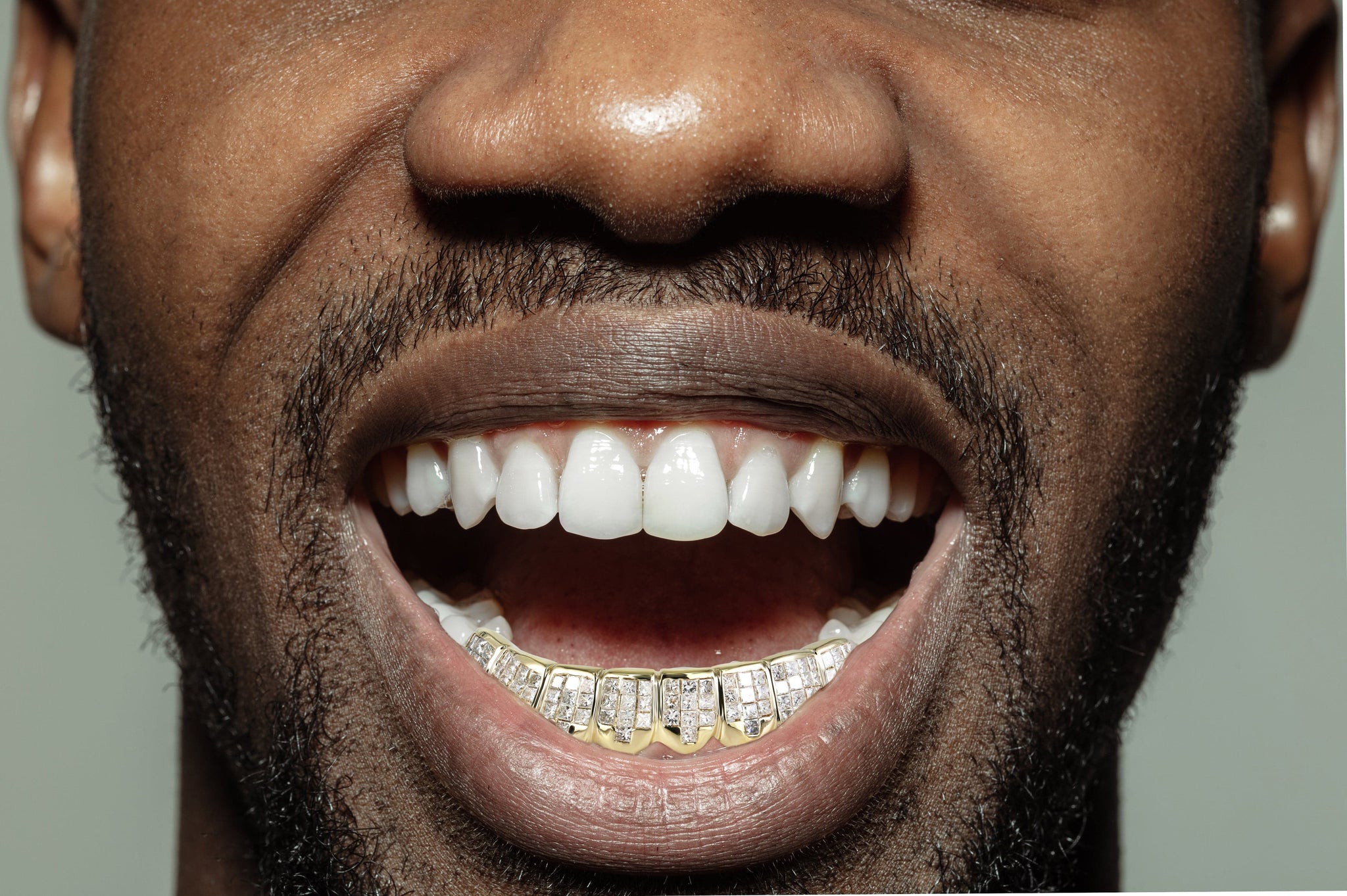 thumbnail image 2 of Two-Tone Sterling Silver & 18K Gold Plated Princess Cut Grillz - Unbranded 2 of 12